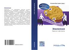 Bookcover of Эпилепсия