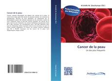 Couverture de Cancer de la peau