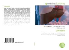 Bookcover of Cirrhosis