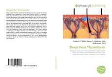 Bookcover of Deep Vein Thrombosis