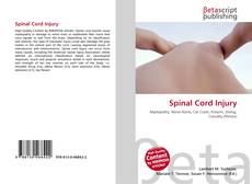 Copertina di Spinal Cord Injury