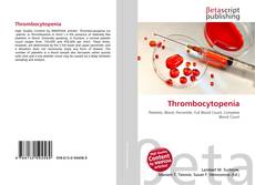 Capa do livro de Thrombocytopenia 
