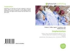 Capa do livro de Implantation 