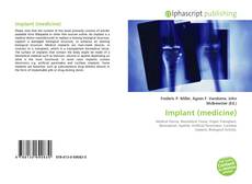 Bookcover of Implant (medicine)