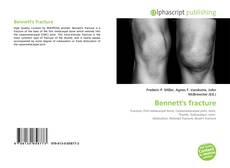 Bookcover of Bennett's fracture