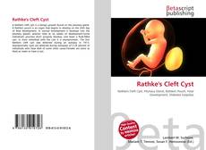 Rathke's Cleft Cyst kitap kapağı