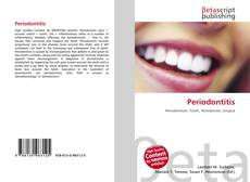 Buchcover von Periodontitis