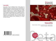 Buchcover von Vasculitis