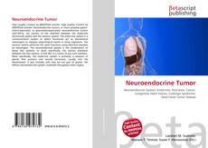 Couverture de Neuroendocrine Tumor