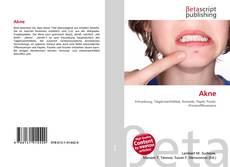 Обложка Akne