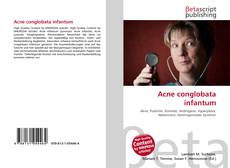 Copertina di Acne conglobata infantum