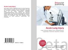 Acute Lung Injury的封面
