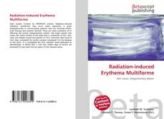 Portada del libro de Radiation-induced Erythema Multiforme