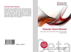 Обложка Valvular Heart Disease