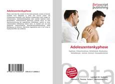 Adoleszentenkyphose的封面