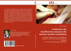 Buchcover von Traitement des insuffisances osseuses des secteurs postéro-maxillaires