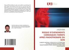 Buchcover von RISQUE D’EVENEMENTS CARDIAQUES TARDIFS APRES RADIOTHERAPIE DU SEIN