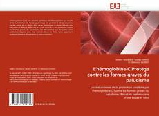 Bookcover of L'hémoglobine-C Protège contre les formes graves du paludisme