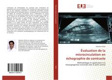 Évaluation de la microcirculation en échographie de contraste的封面