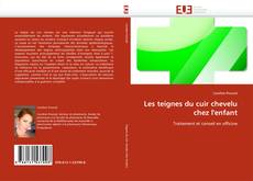 Bookcover of Les teignes du cuir chevelu chez l''enfant