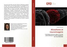 Alcoolisme et neuroimagerie kitap kapağı