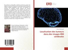 Localisation des tumeurs dans des images IRM cérébrales kitap kapağı
