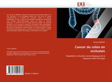 Cancer du colon en occlusion kitap kapağı