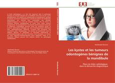 Bookcover of Les kystes et les tumeurs odontogènes bénignes de la mandibule