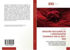 IMAGERIE NUCLEAIRE DE L’ANGIOGENÈSE TUMORALE PAR LE RAFT-RGD kitap kapağı