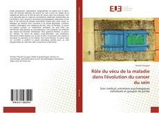 Bookcover of Rôle du vécu de la maladie dans l'évolution du cancer du sein