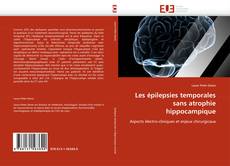 Buchcover von Les épilepsies temporales sans atrophie hippocampique