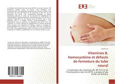 Bookcover of Vitamines B, homocystéine et défauts de fermeture du tube neural