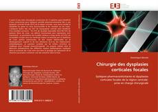 Buchcover von Chirurgie des dysplasies corticales focales