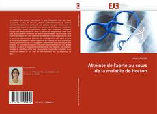 Bookcover of Atteinte de l'aorte au cours de la maladie de Horton