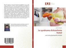 Bookcover of Le syndrome d'alcoolisme foetal
