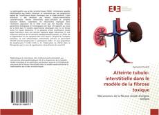 Bookcover of Atteinte tubulo-interstitielle dans le modèle de la fibrose toxique