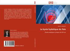 Bookcover of Le kyste hydatique du foie