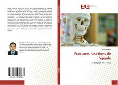 Bookcover of Fractures luxations de l'épaule