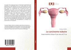 Le carcinome tubaire kitap kapağı