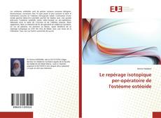 Buchcover von Le repérage isotopique per-opératoire de l'ostéome ostéoide