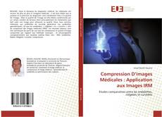 Compression D’images Médicales : Application aux Images IRM kitap kapağı