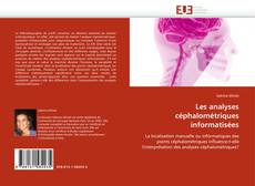 Bookcover of Les analyses céphalométriques informatisées