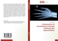 Bookcover of Compression et visualisation d’images médicales par segmentation