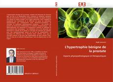Buchcover von L'hypertrophie bénigne de la prostate