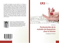 Bookcover of Particularités de la maladie de Dupuytren chez la femme