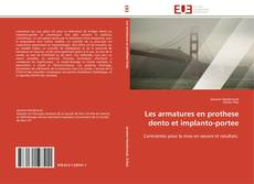 Bookcover of Les armatures en prothese dento et implanto-portee