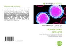 Couverture de Adrenocortical carcinoma