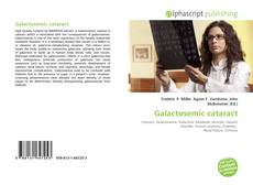 Bookcover of Galactosemic cataract