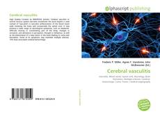 Copertina di Cerebral vasculitis