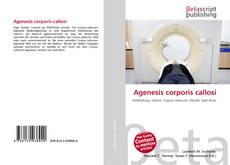 Buchcover von Agenesis corporis callosi
